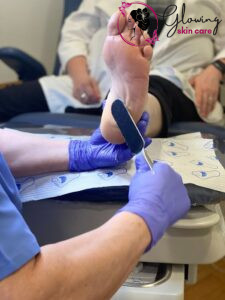 Pedicure